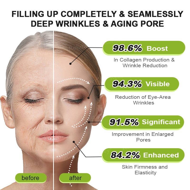Rolimey® Botox & Vita A Retinol Shot Wrinkle-Lift Tightening cream