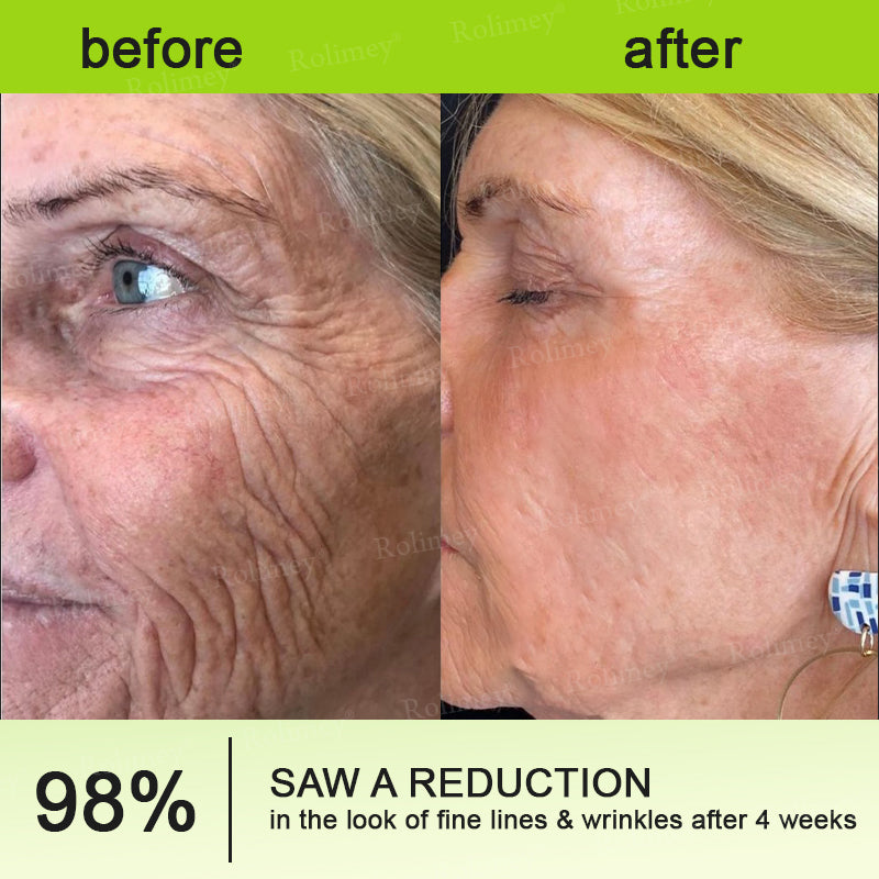 Rolimey® Botox & Vita A Retinol Shot Wrinkle-Lift Tightening cream