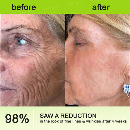 Rolimey® Botox & Vita A Retinol Shot Wrinkle-Lift Tightening cream