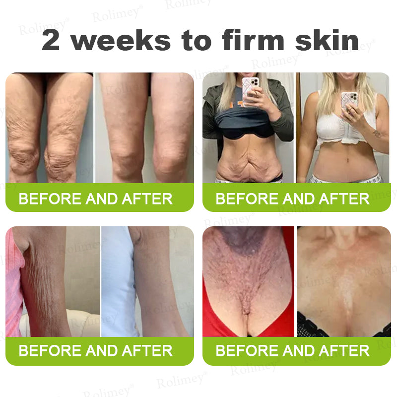 Rolimey® Botox & Vita A Retinol Shot Wrinkle-Lift Tightening cream