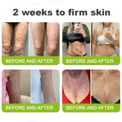 Rolimey® Botox & Vita A Retinol Shot Wrinkle-Lift Tightening cream