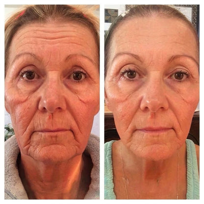 Rolimey® Botox & Vita A Retinol Shot Wrinkle-Lift Tightening cream